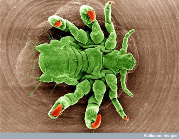 Pubic louse - Ordinary things under the microscope: what do they hide? Лобковая вошь - Обычные вещи под микроскопом