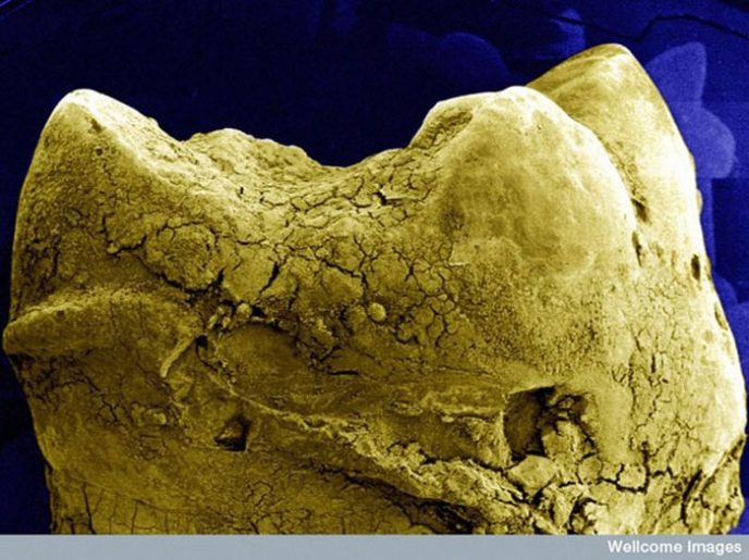 Tooth Surface - Ordinary things under the microscope: what do they hide? Поверхность зуба - Обычные вещи под микроскопом