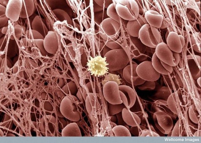 Blood clot - Ordinary things under the microscope: what do they hide? Сгусток крови - Обычные вещи под микроскопом