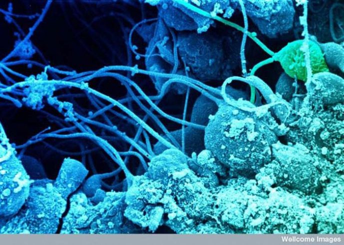 Sperm develops in the testes - Ordinary things under the microscope: what do they hide? Сперматозоиды развиваются в семенниках - Обычные вещи под микроскопом