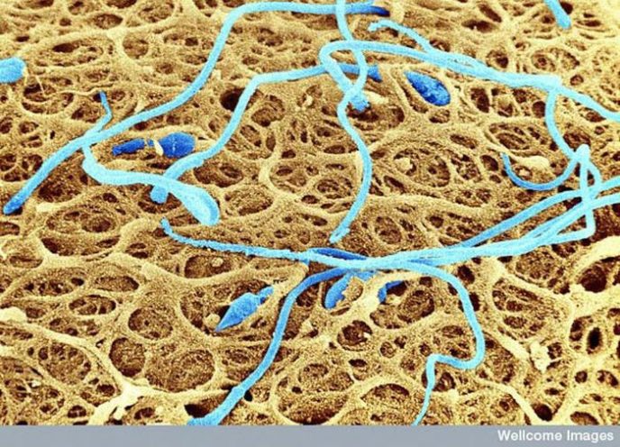 Sperm on the surface of the egg - Ordinary things under the microscope: what do they hide? Сперматозоиды на поверхности яйцеклетки - Обычные вещи под микроскопом