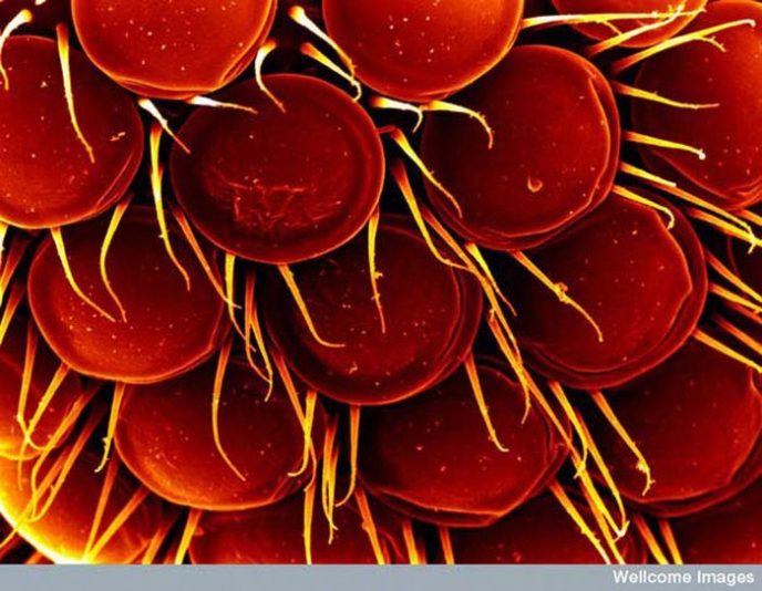 Blackflies eye - Ordinary things under the microscope: what do they hide? Глаз мошки - Обычные вещи под микроскопом