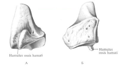 Hook-shaped bone
