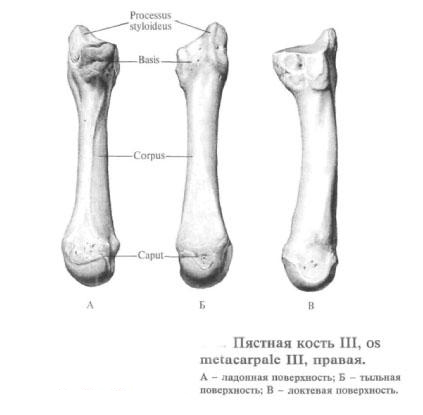The metacarpal bone