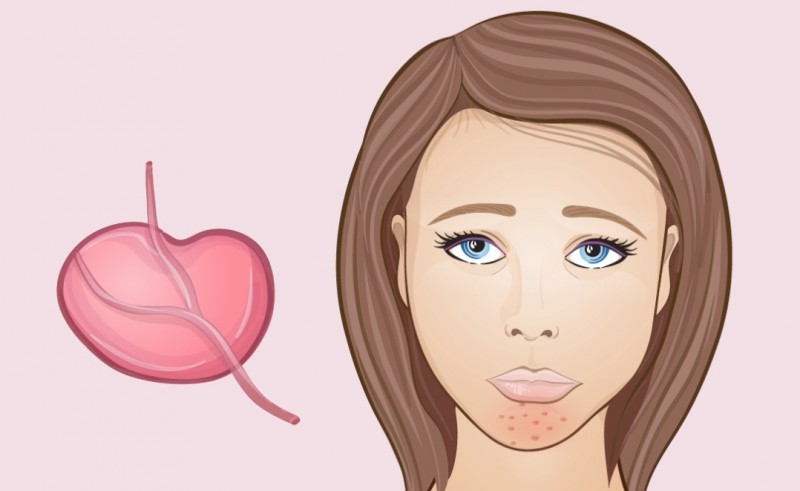 Chin - Changes in the face are signs of unwanted body processes. Подбородок - Изменения на лице