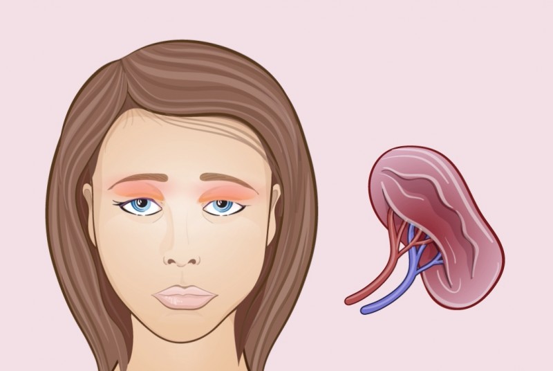 Upper eyelids - Changes in the face are signs of unwanted body processes. Верхние веки - Изменения на лице