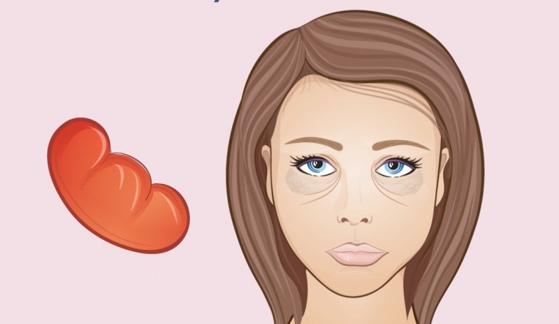 Circles under the eyes - Changes in the face are signs of undesirable processes in the body. Круги под глазами - Изменения на лице