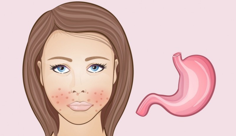 The lower part of the cheeks - Changes in the face are signs of undesirable processes in the body Нижняя часть щек - Изменения на лице