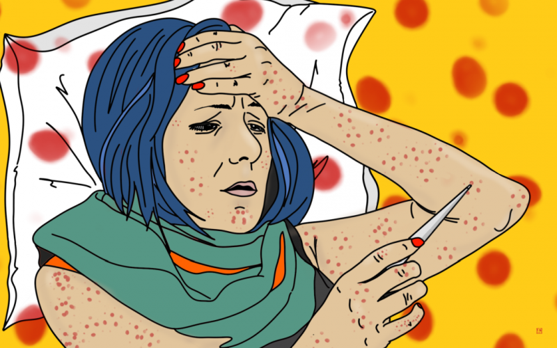 What does chickenpox get from measles and scarlet fever from rubella? Корь, скарлатина, краснуха
