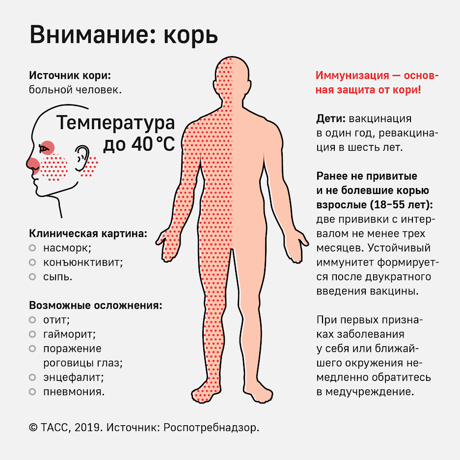 What does chickenpox get from measles and scarlet fever from rubella? Корь, скарлатина, краснуха