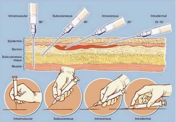 How to do injections at home yourself Как делать уколы дома