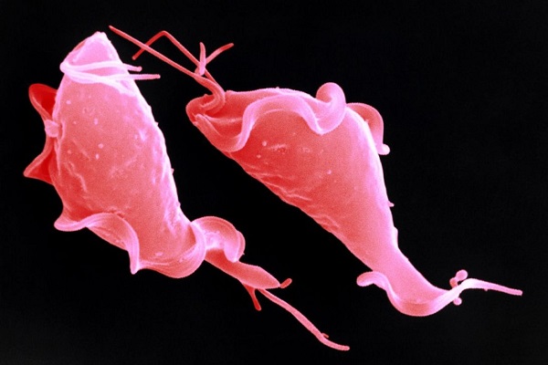 Trichomonas. Insidious parasitic infection in the population Трихомонада