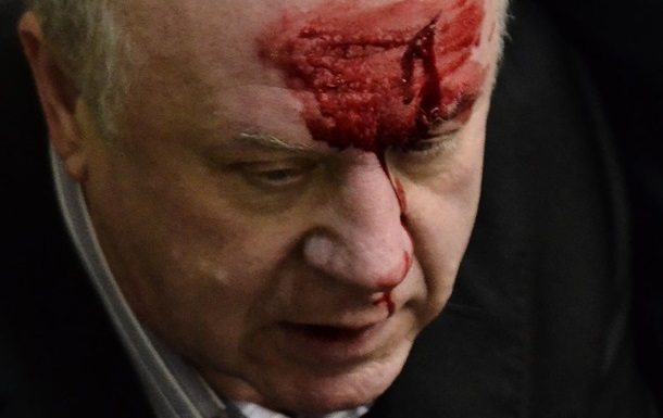 Former security chief Akhmetov broke his forehead in the Rada hall Бывшему шефу безопасности Ахметова разбили лоб в зале Рады