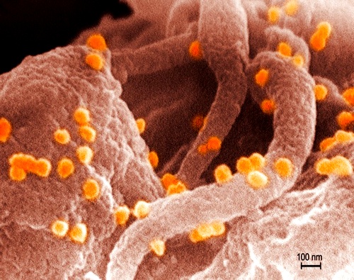 ВИЧ и человеческий лимфоцит (фото Callista Images)
