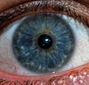 Blue eye - Types of eye colors