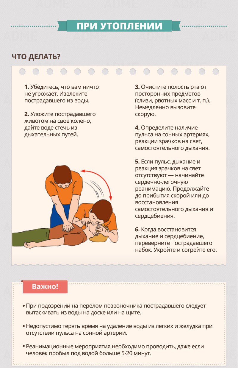 When drowning - First aid guide При утоплении - Гид по оказанию первой помощи