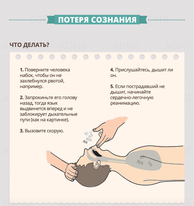 Loss of consciousness - First aid guide Потеря сознания - Гид по оказанию первой помощи