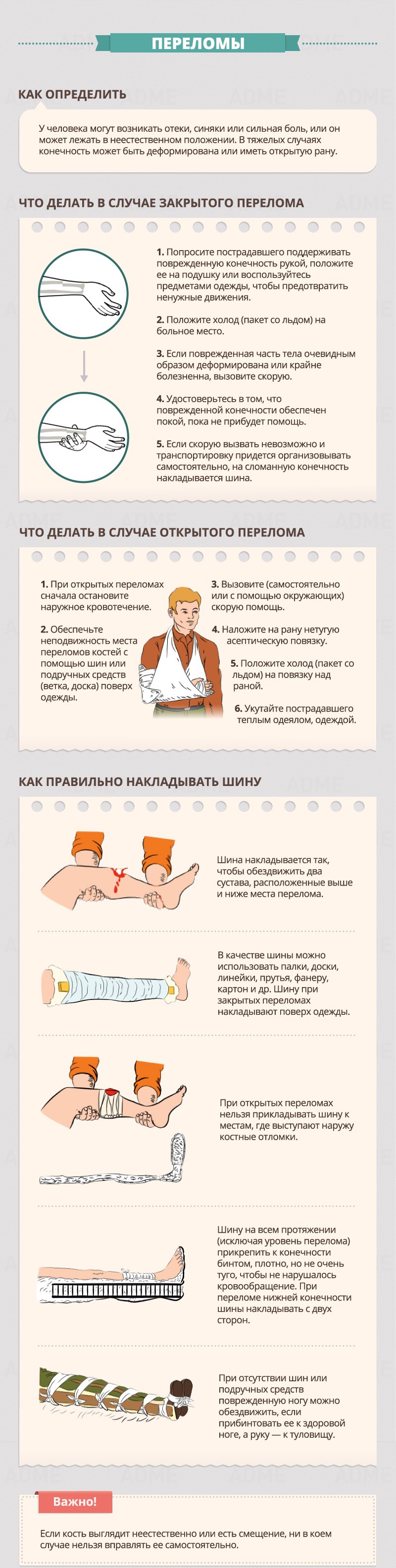 Fractures - First Aid Guide переломы - Гид по оказанию первой помощи