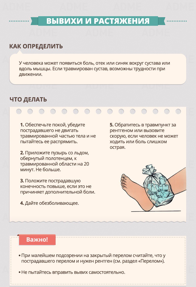 Dislocations and Sprains - First Aid Guide Вывихи и растяжения - Гид по оказанию первой помощи