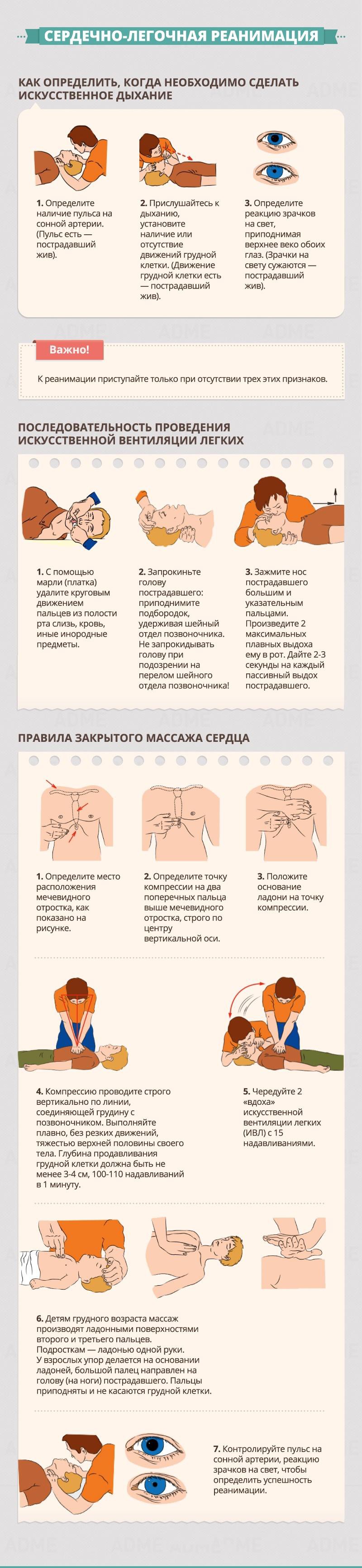 Cardiopulmonary resuscitation - First Aid Guide Сердечно-легочная реанимация - Гид по оказанию первой помощи