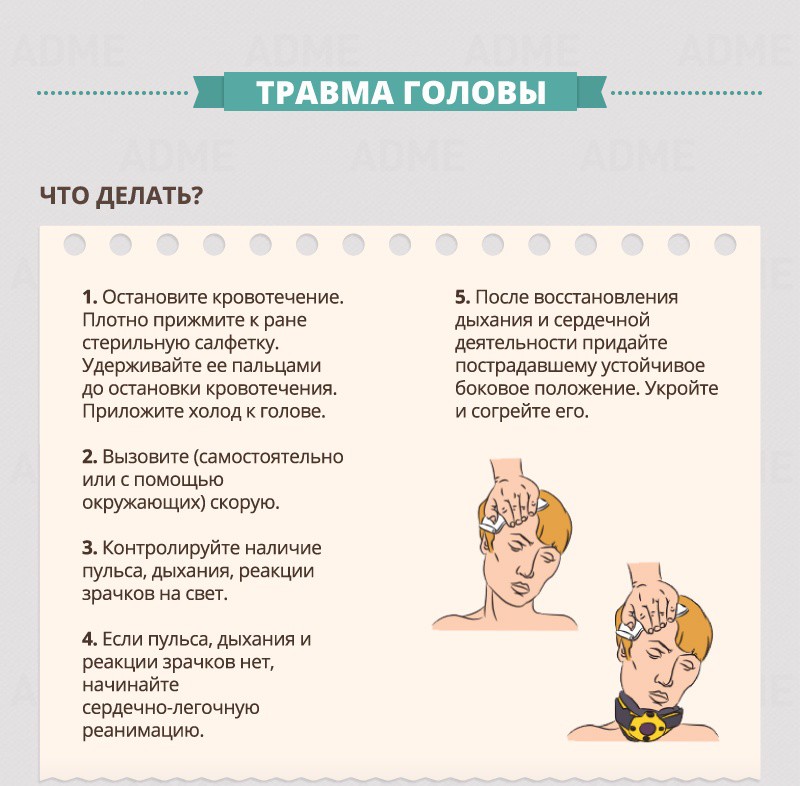 Head injury - First aid guide Травма головы - Гид по оказанию первой помощи