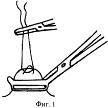 Method of surgical treatment of complicated ulcers front wall of the duodenum