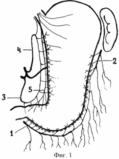 METHOD OF GASTRAP REACTION